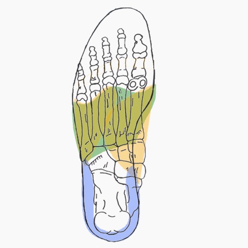 Semelles orthopédiques sur mesure pour adduction avant pied