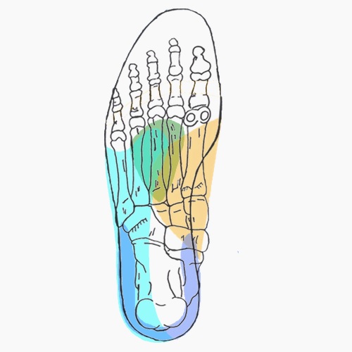 Semelles orthopédiques sur mesure pour entorse de la cheville