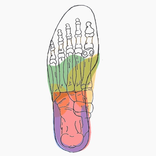 Semelles orthopédiques sur mesure pour gonalgie diffuse