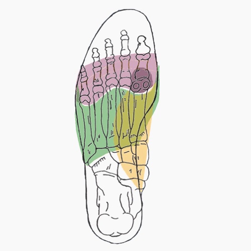 Semelles orthopédiques sur mesure pour hallux rigidus