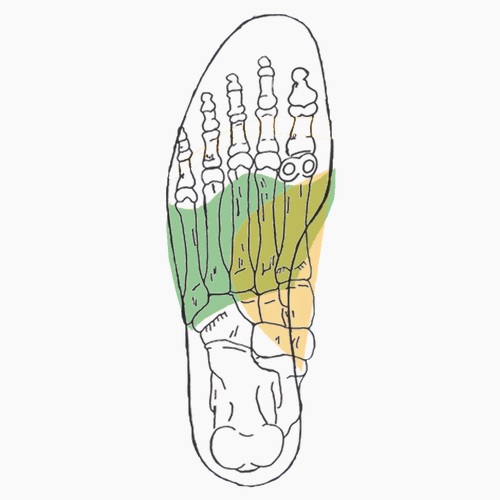 Semelles orthopédiques sur mesure pour pérosite tibiale