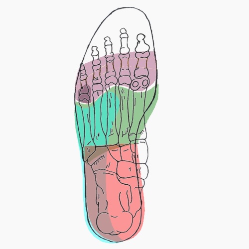 Semelles orthopédiques sur mesure pour pied bot varus equin