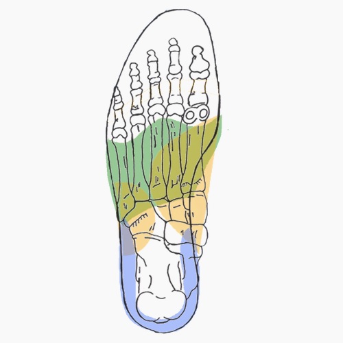Semelles orthopédiques sur mesure pour pied de charcot