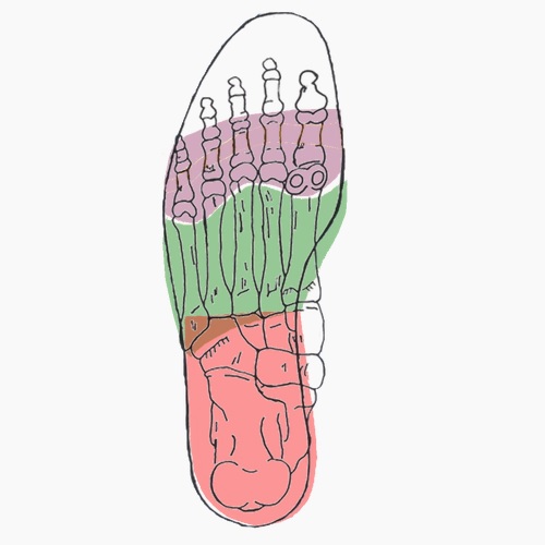 Semelles orthopédiques sur mesure pour pied equin