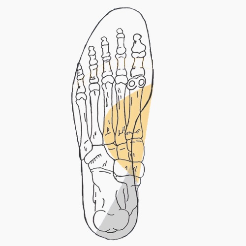 Semelles orthopédiques sur mesure pour pied plat de l'adulte