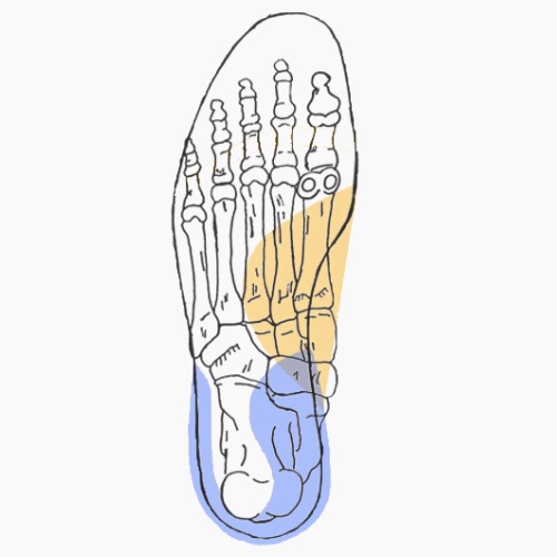 Semelles orthopédiques sur mesure pour tendinite du long flechisseur