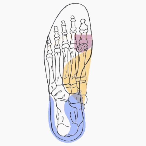 Semelles orthopédiques sur mesure pour tendinite de la patte d'oie