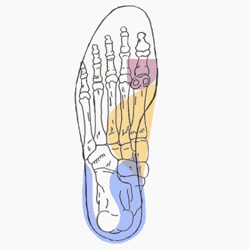 Semelles orthopédiques sur mesure pour tendinite rotulienne